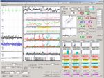 生体信号リアルタイム解析ソフトウェア